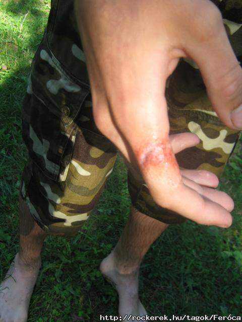 A serulesem