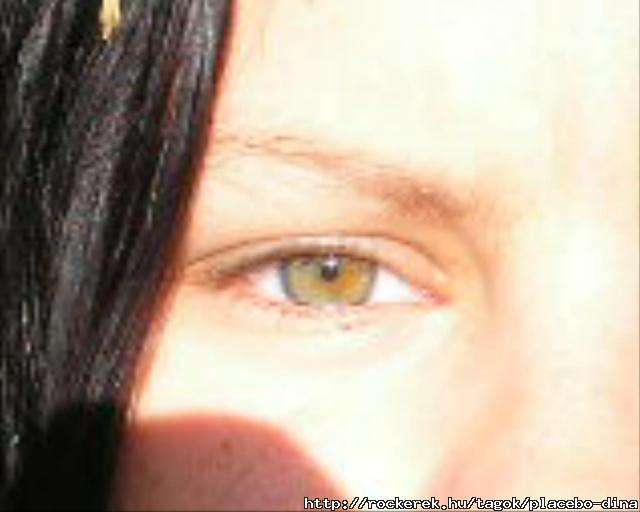 My Eye